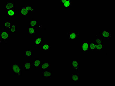 HIST1H1E (Ab-16) Antibody