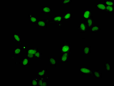 Mono-methyl-HIST1H1E (K25) Antibody