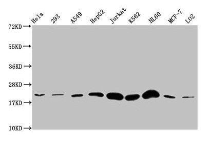 HIST1H1E (Ab-25) Antibody