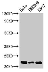 HIST1H1E (Ab-26) Antibody