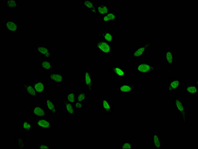 HIST1H1E (Ab-35) Antibody