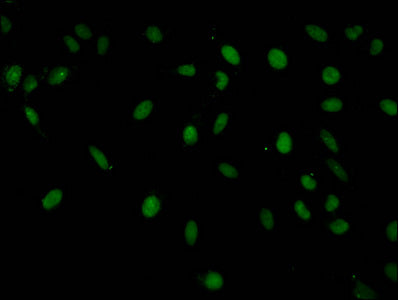 HIST1H1E (Ab-45) Antibody