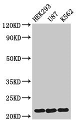 HIST1H1E (Ab-62) Antibody