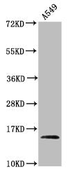 2-hydroxyisobutyryl-HIST1H2AG (K9) Antibody