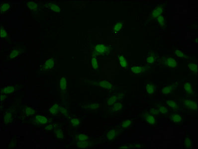 Crotonyl-HIST1H2AG (K118) Antibody