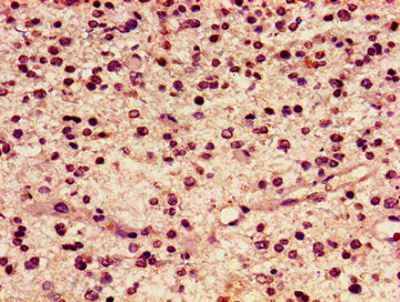 HIST1H2AG (Ab-119) Antibody