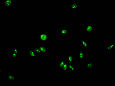 Formyl-HIST1H2AG (K95) Antibody