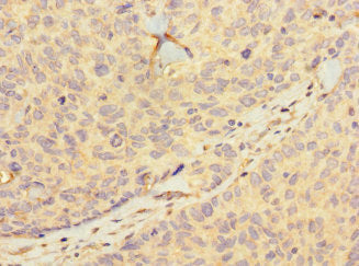 HIST1H2BD Antibody