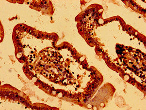 HIST1H2BK Antibody