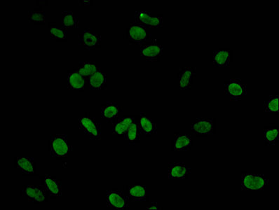 Tri-methyl-HIST1H3A (K9) Antibody