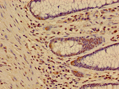 HIST1H3A (Ab-17) Antibody