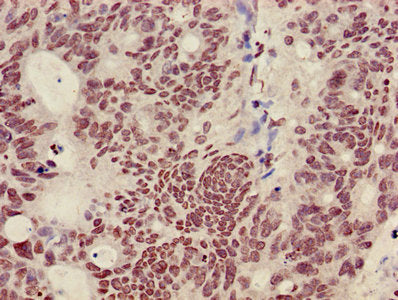 HIST1H3A (Ab-36) Antibody