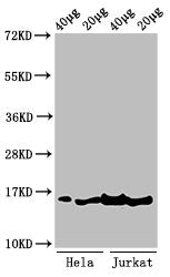 Tri-methyl-HIST1H3A (K36) Antibody