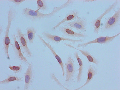 Acetyl-HIST1H4A (K12) Antibody