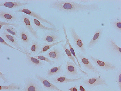 Acetyl-HIST1H4A (K12) Antibody