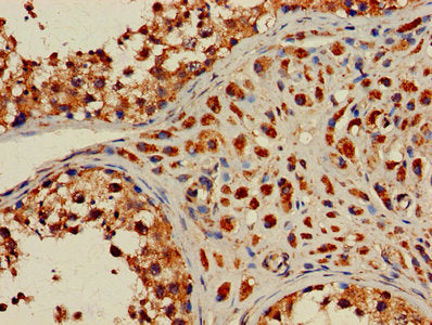 HIST2H2AC Antibody