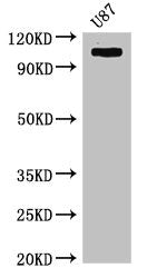 HK2 Antibody