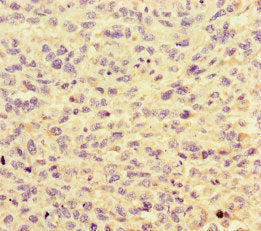 HNRNPF Antibody