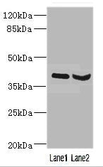 HOXD10 Antibody