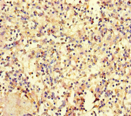 HOXD9 Antibody