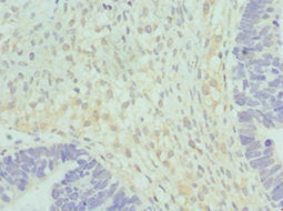 HSD17B2 Antibody
