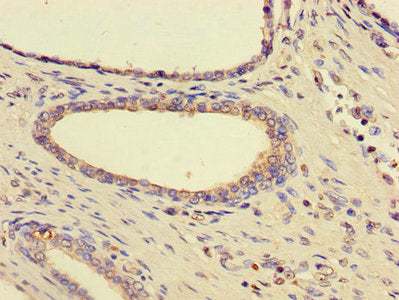 HSPA9 Antibody