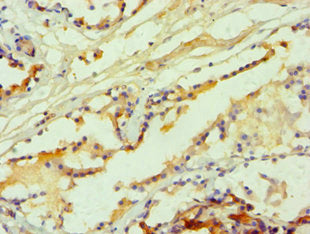 HTR2B Antibody