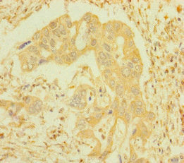IFITM5 Antibody