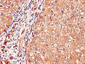 IGHMBP2 Antibody