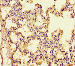 IL13 Antibody