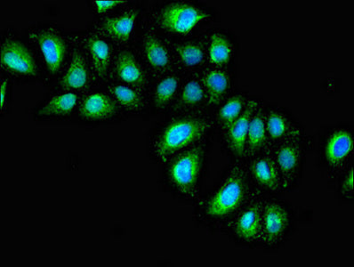 IL1R1 Antibody