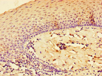 IL33 Antibody