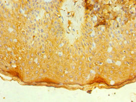 IL7R Antibody