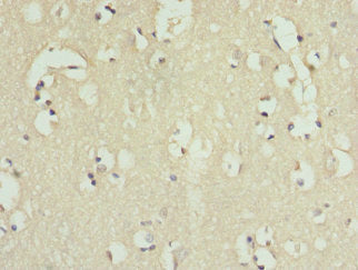 IL9R Antibody