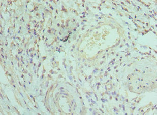 IRAK3 Antibody