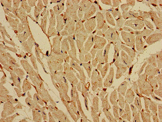IREB2 Antibody