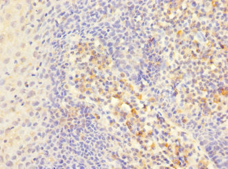 ITGAE Antibody