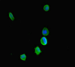 KDM5C Antibody