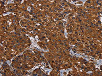 HYAL2 Antibody