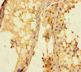 KDM4A Antibody