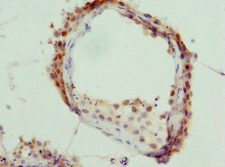 KHDRBS3 Antibody