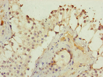 KIAA0391 Antibody