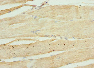 KIF1B Antibody