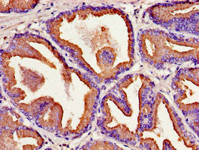 KLK2 Antibody