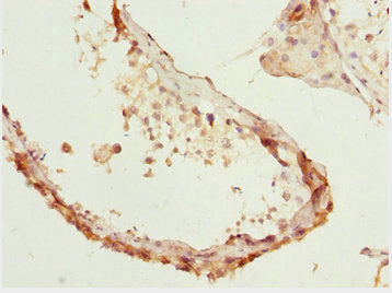 KPNA5 Antibody