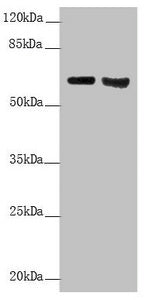 KRT6A Antibody