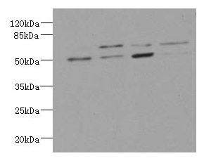 LDB3 Antibody