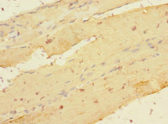 LDB3 Antibody