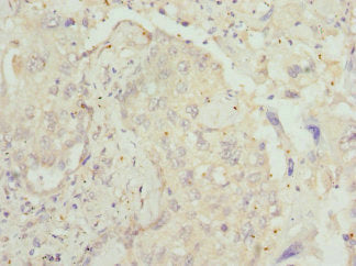 CNMD Antibody