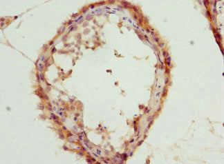 LGALS8 Antibody